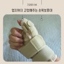손목통증 방치하다 주사까지...엄지고정 건초염 손목보호대 바디숨 후기