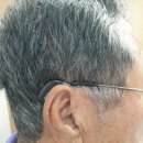 베테랑보청기 | 노원보청기 믿고 맡길 수 있는 베테랑보청기
