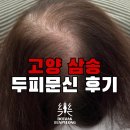 고양 삼송두피문신 잘하는 곳 찾는다면 – 50대 여성 리얼 후기 공개