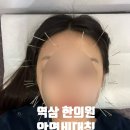 동일한의원 | [서울 강남] 퇴근 후 야간진료 가능한 역삼 한의원 안면비대칭 안면윤곽 교정 후기