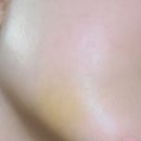 목동예치과ㅣ귀차니즘이 무서움을 이긴 사랑니 4개 발치 후기