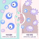 솔보