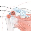 왼쪽 오른쪽 어깨통증원인 회전근개파열 or 어깨충돌증후군 이미지