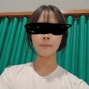 (주)신원그린 | [교정일기12] 양악수술 핀제거 후기_양악 9개월 뒤