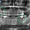 좌동로 93 이미지