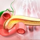생존율 최하 췌장암, '이것' 신호 살펴야 이미지