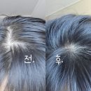 떡진머리 지성 두피 스트레스엔 퓨어바이제이 약산성샴푸