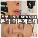 꿈마을유치원 | 포항 문덕 피부관리 어본 에스테 이중턱관리 신상기기 오토젯 후기(통증/부작용/주의사항)