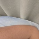 대해한의원 | 수원 모공각화증 치료 약초필링 한의원 2회차 후기