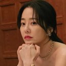 이마거상술 수술 일지 14 - 50대 고현정 같은 동안 눈매를 위한 눈썹 거상 후기