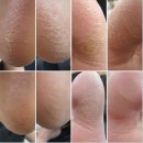 굿네일 | 양주발각질 세심한 전문케어 후기 굿네일