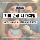 우리아이치과 | 유치 흔들림부터 치과치료까지, 우리 아이 치아깁스 후기 관리꿀팁