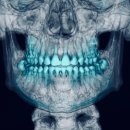 서울바른이치과교정과치과의원 이미지