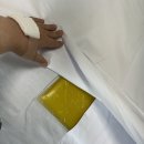 디섹 | 각막내피이식 DSAEK 디섹/ 부분각막이식&백내장 수술 후기 입원일지