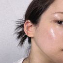 온더볼운동 | 여수학동피부과 여수피부관리 EXNAEL엑사네르 후기 피부결 달라진 관리 후기