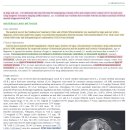 개와 고양이에서 intracranial meningioma와 관련되어 나타나는 brain herniation 이미지