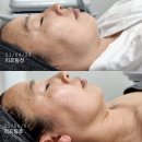 화이트스킨케어 이미지