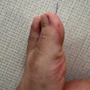 햇빛어린이집(구 톰과제리) | 수족구 잠복기와 전염 증상, 구내염과의 차이? 성인 수족구?