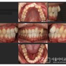 아미치과의원 | [인천교정치과] 아이 교정하러 왔다가 아빠도 시작했어요, 성인남성치아교정 (서울아미교정치과)