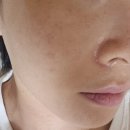 더올린의원 | 논산피부과 더올린의원 다녀왔어요^^