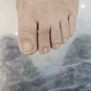 레푸스인천부평씨지브이(CGV)점 | 부평 발톱무좀 만족후기., 레푸스부평CGV점