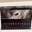 김천시 보건소3층 화장실 | 지옥의 입덧 시작 : 임산부 꿀템 쇼핑(유니클로, 포트레), 남양주 보건소 산전검사 후기