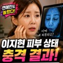 미서 | 이지현 피부 상태 충격 결과 | 뷰티 클리닉 터치미서 밝혀진 피부 진단