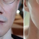 인셀덤 동안 이미지