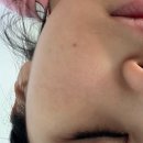 셀리핏 | 분당모공관리 추천 셀리올리스킨랩 트라이엄 포어핏 후기