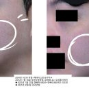스프링봄봄