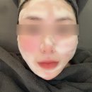 인프릭스인터내셔널(주) | 창원피부관리,창원중동피부관리 추천 : 뉴욕부티크 에스테틱 하이푸 리프팅관리 후기
