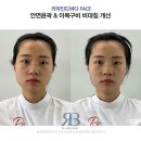 리마인드PT 이미지