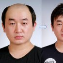 가발전성시대