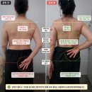 익산뷰티센터 | 익산 뷰티센터 뭉치고 불편한 등 어깨 관리 30분의 마사지 변화