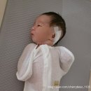 정병원 | 강남 세브란스 병원 신생아 컵귀 귀교정 후기