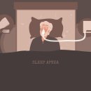 코골이·수면 무호흡증, 파킨슨병 경고신호…양압기 치료 시 위험 30% 감소 이미지