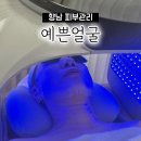 예쁜얼굴 | 향남 피부관리 / 예쁜얼굴에서 엑소좀 앰플관리 후기