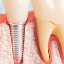 이승희디지털치과의원 이미지