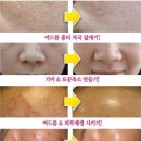 르네셀 이미지