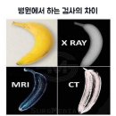 2월 6일(일) 뇌 질환, 정확한 진단이 필요하면? 뇌 MRI 검사 이미지