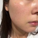 앤약국 | 약국화장품 재생크림 28일 사용후기 리쥬앤28