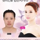 김준희헤어라인