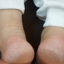 기테라피