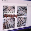 닥터에이스 | 산본두피관리 정수리냄새 비듬 각질케어잘하는 닥터모락 솔직후기