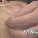 렛미인피부