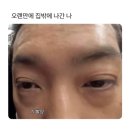 킷사코이 이미지
