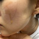 부활약국 - 구미시 구미중앙로 58 | 부활앰플 후기 화석기미 고민에 써본 비타터닝 나노샷 앰플 기미없애는법 추천✨