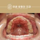 연세쌍둥이치과교정과치과의원 이미지