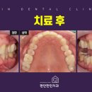 편안한민치과 이미지