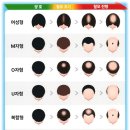 영산대학교(해운대) 미용 예술대학원 | [부산 탈모 전문 헤어톡톡] 탈모의 원인과 단계별 맞춤형 해결책